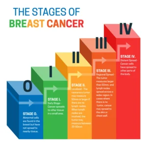 Infographic showing the stages of breast cancer from Stage 0 to Stage IV in colored step blocks, explaining tumor size, lymph node involvement, and distant spread.