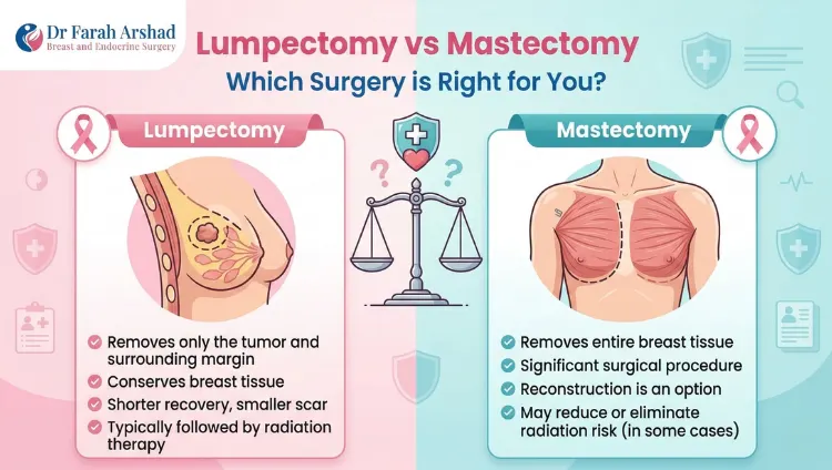 Lumpectomy vs Mastectomy: Which Surgery Is Right for You?