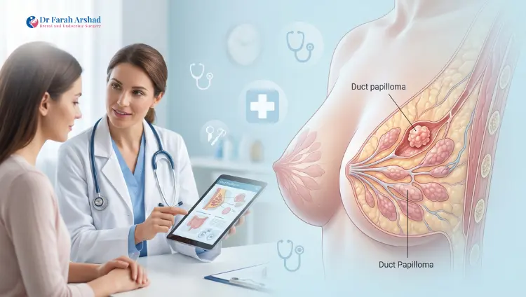 What Are Duct Papillomas? Symptoms, Diagnosis & Surgery Option